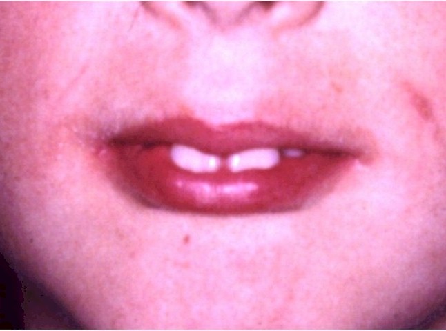 fcl1_028_min_mod.jpg (50659 byte)